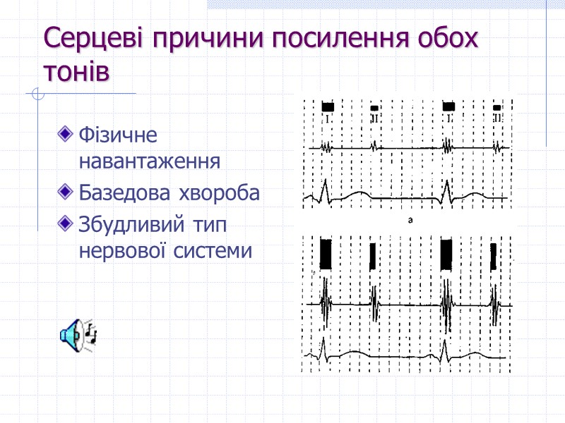 Серцеві причини посилення обох тонів Фізичне навантаження Базедова хвороба Збудливий тип нервової системи